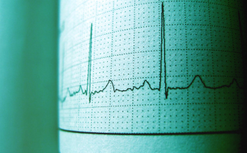 Kalkulator kardiovaskularnog rizika ASCVD Risk Estimator Plus: Vaš vodič za zdravlje srca