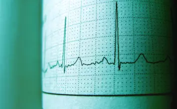 Kalkulator kardiovaskularnog rizika ASCVD Risk Estimator Plus: Vaš vodič za zdravlje srca