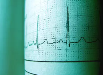 Kalkulator kardiovaskularnog rizika ASCVD Risk Estimator Plus: Vaš vodič za zdravlje srca