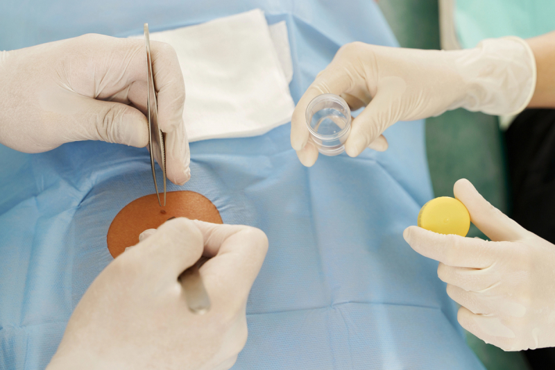 Biopsija i phd nalaz operacija 1