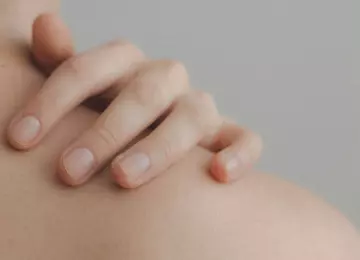 Melanom kože: Rano prepoznavanje može spasiti život