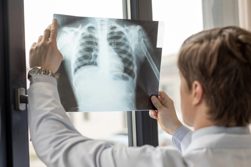5 medicinskih otkrica rentgen