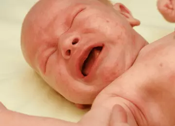 Najčešće alergije kod beba i djece te kako ih prepoznati