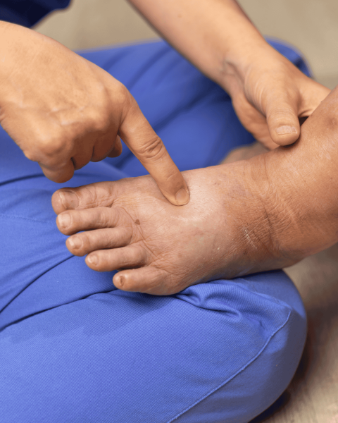 Natecenost i zdravstveni problemi