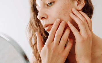 Promjene na koži koje otkrivaju ozbiljne zdravstvene probleme