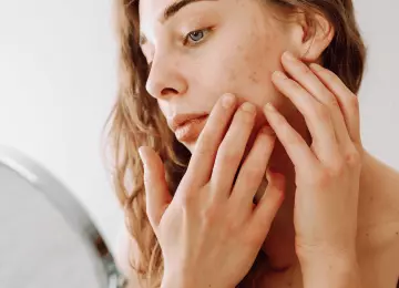 Promjene na koži koje otkrivaju ozbiljne zdravstvene probleme