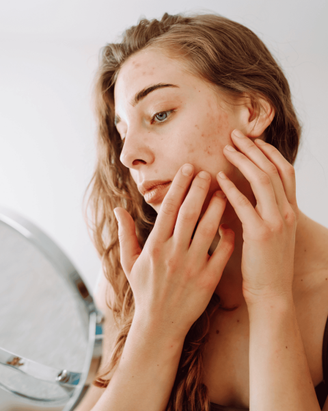 Promjene na kozi i zdravstveni problemi