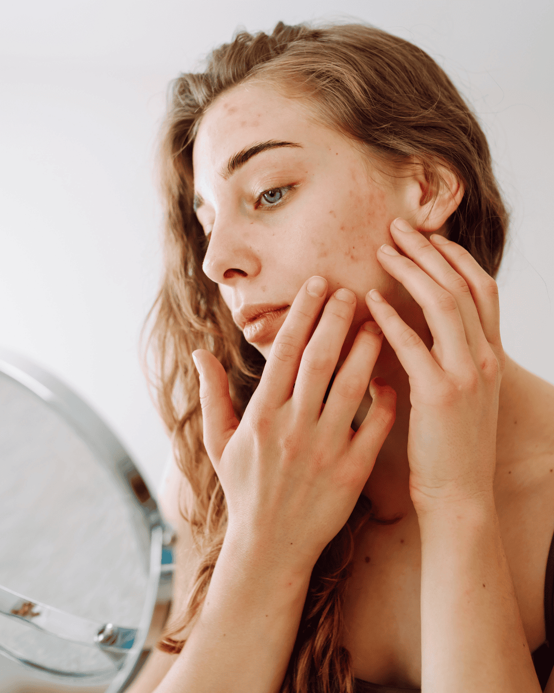 Promjene na koži koje otkrivaju ozbiljne zdravstvene probleme