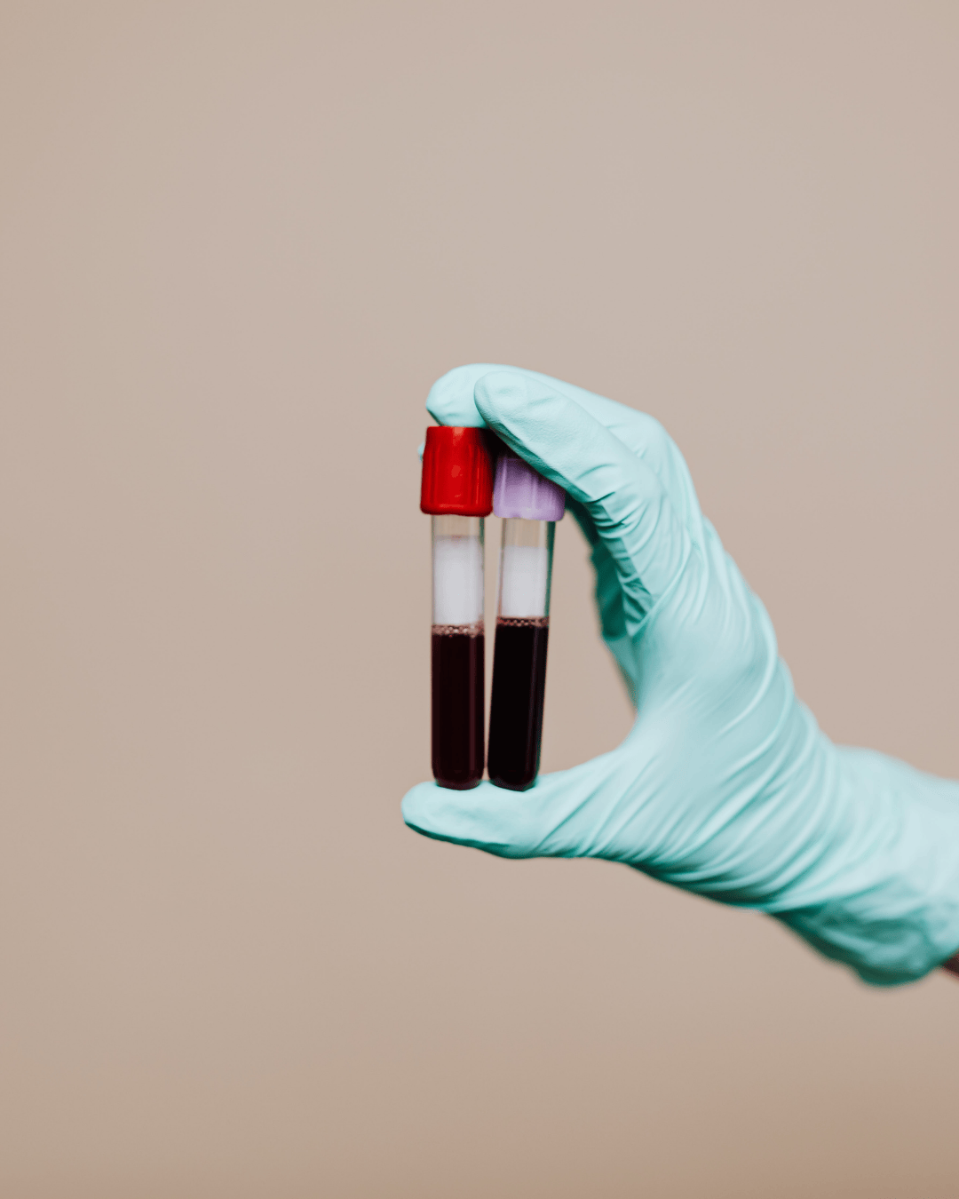 Trombofilija: tihi ubojica koji utječe na trudnoće i napada srce