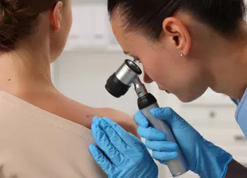 Trebate li na pregled madeža prije ili poslije ljeta