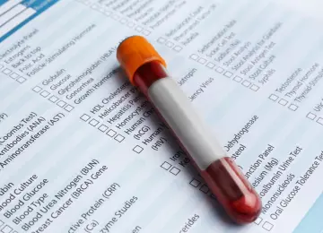 Dobijete nalaz krvi i ne razumijete ništa: evo što znače osnovne vrijednosti
